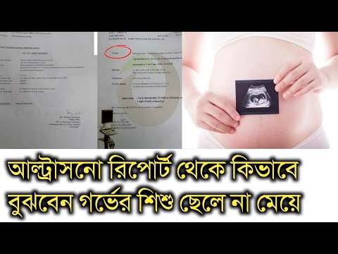 ভিডিও: কীভাবে একটি ভাল টিপোট বাছাই করা যায়