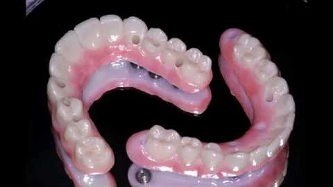 How do I keep my lower denture in place?