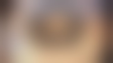 Repositioning of Subluxate IOL Capsular Bag Complex