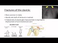 FRACTURES OF UPPER LIMB |CLAVICLE | SHOULDER JOINT DISLOCATION|