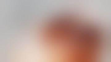 Robot-assisted Laparoscopic Extended Pelvic Lymphadenectomy