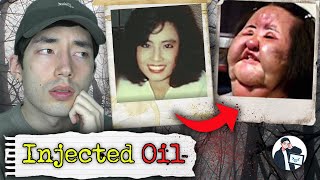 Why Did This Korean Singer Inject Her Face With Oil? | The Case of Hang Mioku by TerryTV 87,748 views 2 years ago 14 minutes, 40 seconds