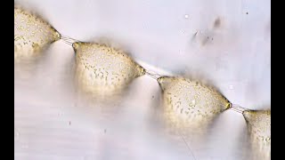 Marine diatom @ThaiMicrocosmos