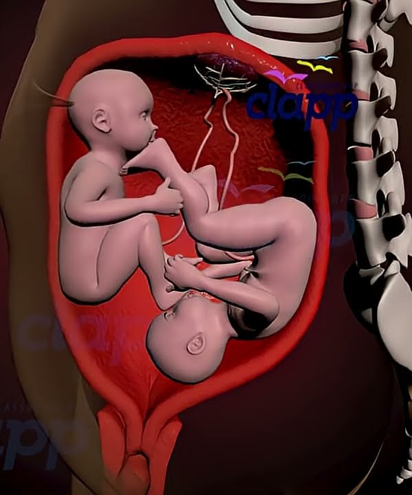 Twins fights inside the Womb (3D Animation)