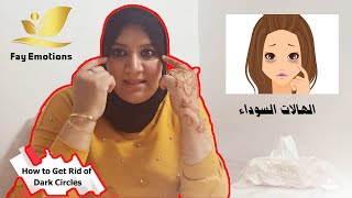 How to Get Rid of Dark Circles ?? وصفة مجربة للهالات السوداء تحت العينين