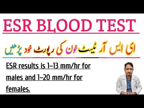 ESR BLOOD TEST Urdu Hindi  Irfan Azeem