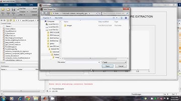 IEEE 2013 IP Automated detection of diabetic retinopathy in blurred digital fundus images