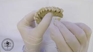 Спланхнология, анатомия зубов