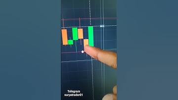 📊Binary Options Trading📈 |Quotex Trading | #shorts #quotex #binarytrading #viral