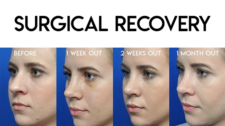 Surgical Recovery