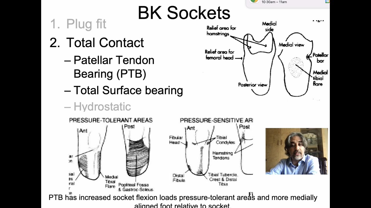 GMNR Legacy Series: Intro to Prosthetics