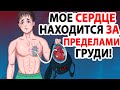 Мое Сердце Находится за Пределами Тела. Однажды я его Потерял!