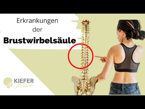 Video: Osteochondrose Der Brustwirbelsäule - Ursachen, Symptome Und Behandlung