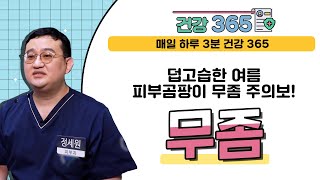 [건강365] 덥고습한 여름, 피부곰팡이 무좀 주의보! 무좀 (정세원 원장/ 051-558-7575)