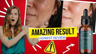 ILLUDERMA - ((️HONEST REVIEW!!️)) – Illuderma Review - Illuderma Results – Iluderma