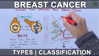 Breast Cancer and its types