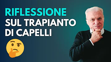 Quante volte si può fare il trapianto di capelli?