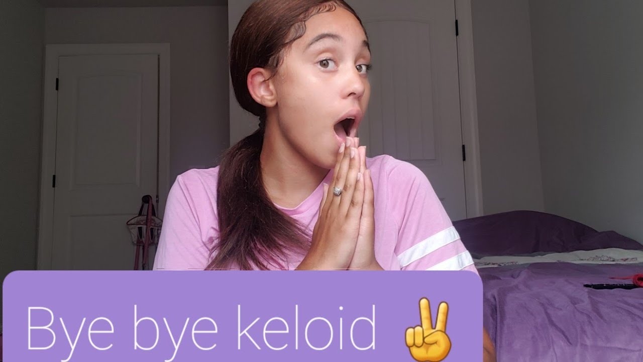 How to remove a keloid(rubber band method) GRAPHIC IMAGES YouTube