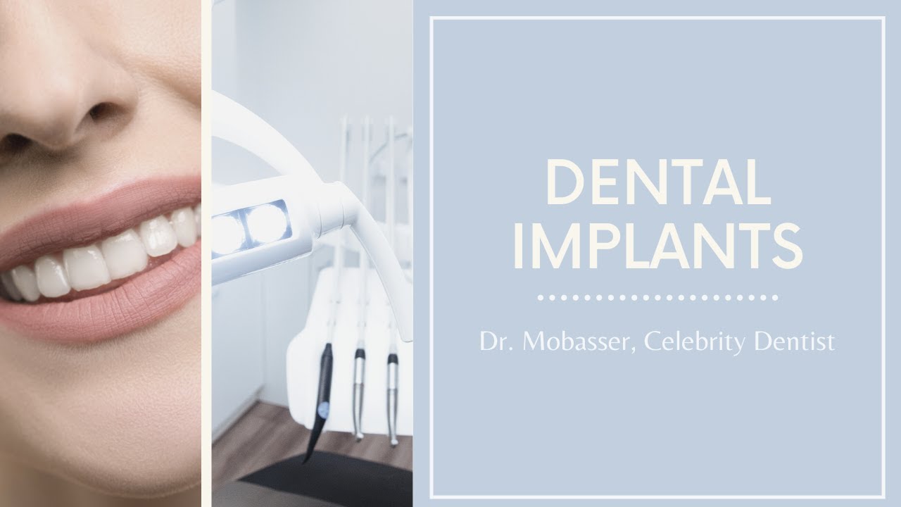 Dental Implants Los Angeles Beverly Hills West Hollywood CA