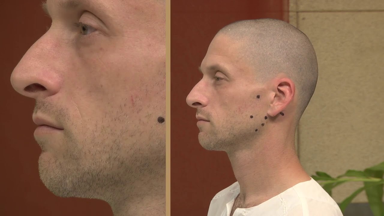 School of Thai Acupressure Points for Jaw Pain (TMJ) Learn about