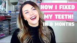 HOW I FIXED MY WONKY TEETH IN 8 MONTHS!! Six Month Smiles!