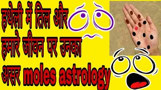 हथेली में तिल और हमारे जीवन पर उनका असर || moles astrology || BY SUVO TV IN HINDI AND BENGALI