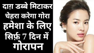 REMOVE PIMPLE MARKS AND PIMPLE HOLE IN 7 DAYS Reduce Pimple hole| Remove Pimple Marks and Open Pores
