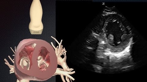 Basic Cardiac Ultrasound Views 2:  Parasternal Short Axis