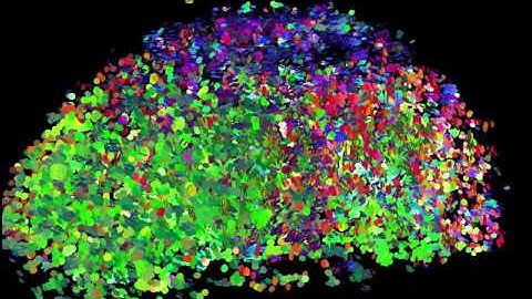 Diffusion Tensor Tractography DTI MRI 3 - William Edward Hahn