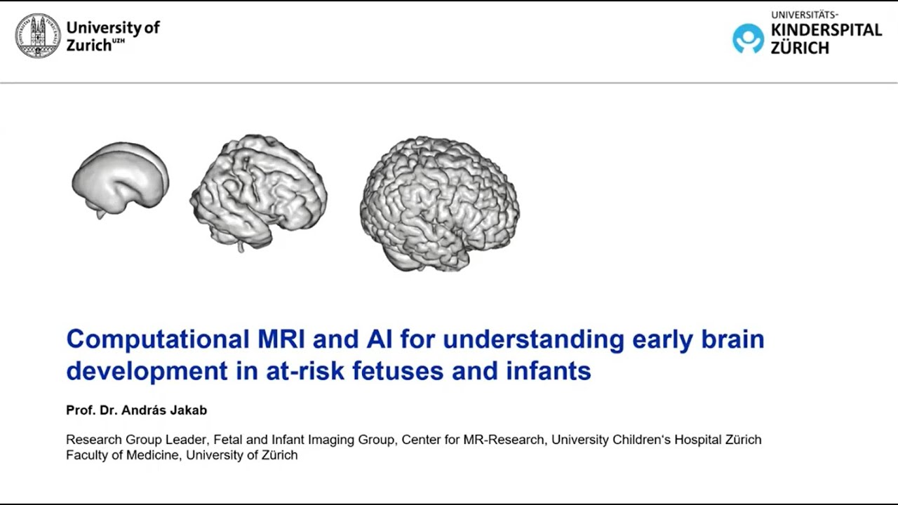 Computational MRI and AI for understanding early brain development in at-risk fetuses and infants