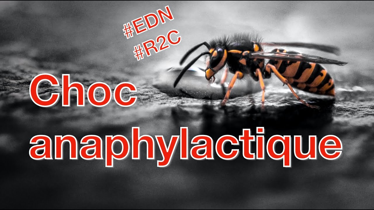 Oedème de Quincke et anaphylaxie - Item 338 de l'EDN