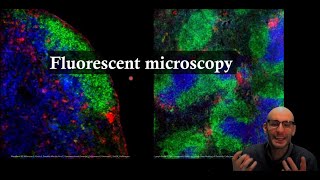 How does Fluorescent microscopy work?