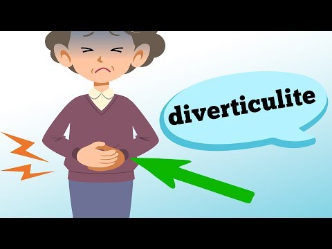 O que é DIVERTICULITE e quais os sintomas?