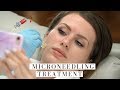 I Did Microneedling AQUAGOLD Fine Touch Treatment | Watch the Procedure | BTS