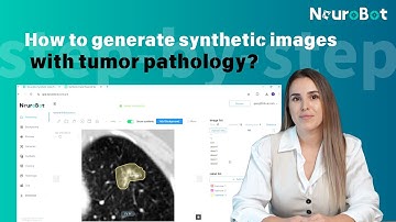 How to generate synthetic images with tumor pathology?#medicalaid    #SyntheticData #HealthcareTech
