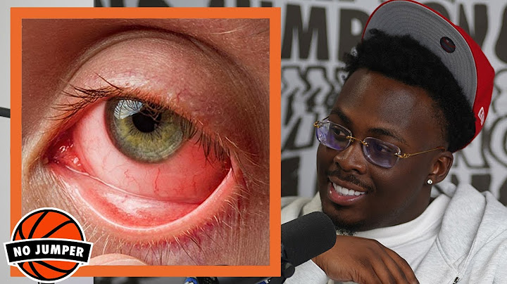 C Stunna Shares the Insane Story of Why He Needs to Wear Glasses