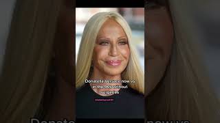Celebrity Donatella now VS. before surgeries #donatellaversace #shorts Profile