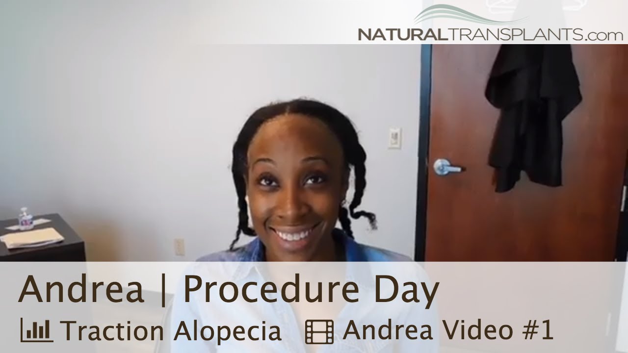 fue hair transplant month by month Hair Loss Help | Alopecia Treatment (Andrea)
