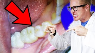 Dentist Explains Every Cause of TOOTH THROBS & PULSATING GUMS! Even Pain that Comes and Goes.