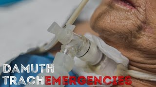 Tracheostomy Emergencies