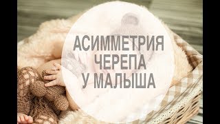 АСИММЕТРИЯ ЧЕРЕПА У РЕБЕНКА. СКОШЕННАЯ ГОЛОВА. НОРМА ИЛИ ПАТОЛОГИЯ?