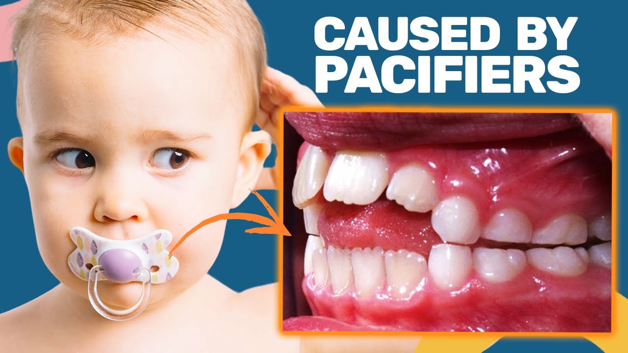 The Dangers of Pacifier Use And How to Avoid Them