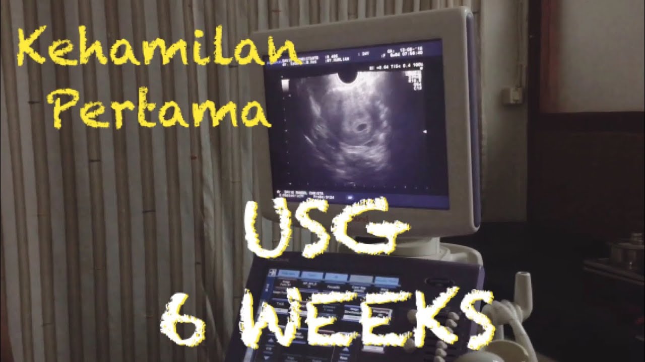 Kehamilan Pertama - USG 6 Minggu (1 Bulan di Diagnosa ...