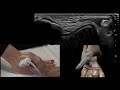 Demostracion en tiempo real ecografa de los ligamentos externos tobillo