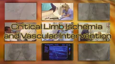 Critical Limb Eschemia and Vascular Introductory Course ** Teaser Trailer
