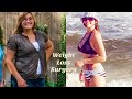 *MY BARIATRIC SURGERY* Lap Band - Gastric Sleeve **Before and After!