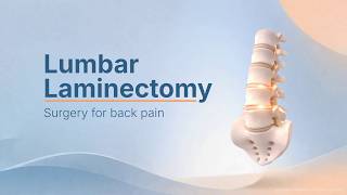 Laminectomy Surgery| Medical Animation | Spine Surgery Procedure