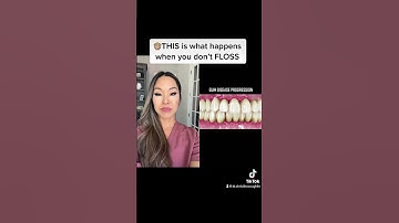 THIS is what happens when you don’t FLOSS #shorts