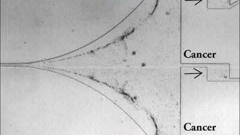 Deformability Activated Cell Sorting