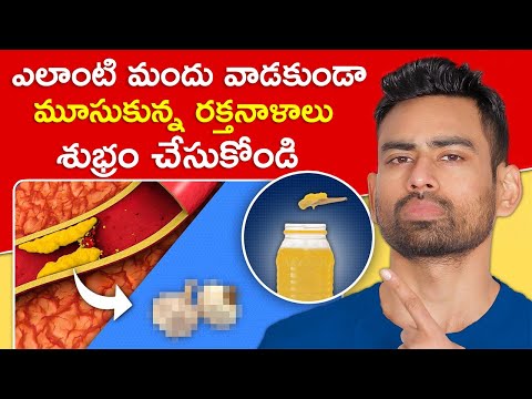 మూసుకున్న రక్తనాళాలు Blocked Arteries శుభ్రం చేయండి ఈ 5 పద్ధతులతో Fit Tuber Telugu